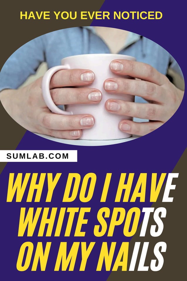 why do i have white spots on my nails..? PDF