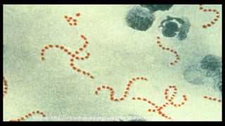 Source:	
  h"p://en.wikipedia.org/wiki/File:Streptococcus_pyogenes.jpg	
  
 