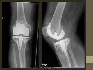 Annual Regional Orthopaedic symposium Nizwa
 