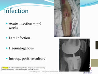 Infection
 Acute infection – 3- 6
weeks
 Late Infection
 Haematogenous
 Intraop. positive culture
Annual Regional Orthopaedic symposium Nizwa
 