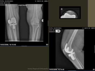 Annual Regional Orthopaedic symposium Nizwa
 