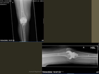 Annual Regional Orthopaedic symposium Nizwa
 