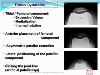 Patellar Dysfunction
• Tibial / Femoral component
- Excessive Valgus
- Medialization
- Internal rotation
• Anterior placement of femoral
component
• Asymmetric patellar resection
• Lateral positioning of the patellar
component
• Raising the joint line
(artificial patella baja)
Annual Regional Orthopaedic symposium Nizwa
 