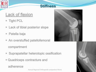 Stiffness
Annual Regional Orthopaedic symposium Nizwa
 