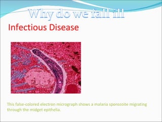 Infectious Disease This false-colored electron micrograph shows a malaria sporozoite migrating through the midget epithelia. 