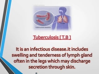Tuberculosis [T.B ]
It is an infectious disease.it includes
swelling and tenderness of lymph gland
often in the legs which may discharge
secretion through skin.
 