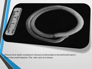Picture of an adult roundworm (Ascaris lumbricoides is the technical name )
From the small intestine .The ruler next to it shows
 