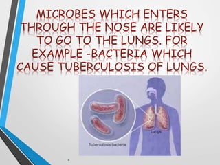 MICROBES WHICH ENTERS
THROUGH THE NOSE ARE LIKELY
TO GO TO THE LUNGS. FOR
EXAMPLE -BACTERIA WHICH
CAUSE TUBERCULOSIS OF LUNGS.
 