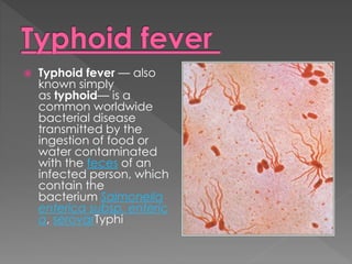  Typhoid fever — also
known simply
as typhoid— is a
common worldwide
bacterial disease
transmitted by the
ingestion of fo...