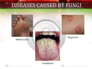 DISEASES CAUSED BY FUNGI
Athlete’s foot
Ringworm
Candidiasis
 