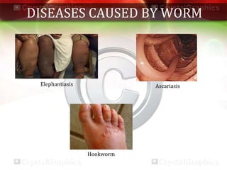 DISEASES CAUSED BY WORM
Ascariasis
Hookworm
Elephantiasis
 