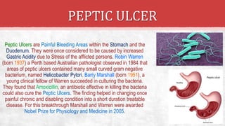 PEPTIC ULCER
Peptic Ulcers are Painful Bleeding Areas within the Stomach and the
Duodenum. They were once considered to be caused by increased
Gastric Acidity due to Stress of the afflicted persons. Robin Warren
(born 1937) a Perth based Australian pathologist observed in 1984 that
areas of peptic ulcers contained many small curved gram negative
bacterium, named Helicobacter Pylori. Barry Marshall (born 1951), a
young clinical fellow of Warren succeeded in culturing the bacteria.
They found that Amoxicillin, an antibiotic effective in killing the bacteria
could also cure the Peptic Ulcers. The finding helped in changing once
painful chronic and disabling condition into a short duration treatable
disease. For this breakthrough Marshall and Warren were awarded
Nobel Prize for Physiology and Medicine in 2005.
 