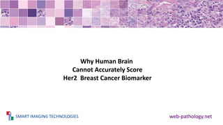 SMART IMAGING TECHNOLOGIES web-pathology.net
Why Human Brain
Cannot Accurately Score
Her2 Breast Cancer Biomarker
 