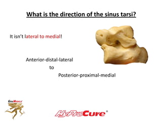 What is the direction of the sinus tarsi?
It isn’t lateral to medial!
Anterior-distal-lateral
to
Posterior-proximal-medial
 