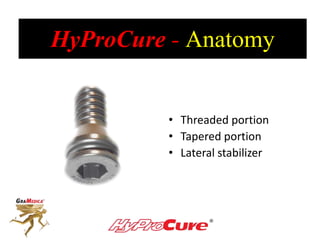 HyProCure - Anatomy
• Threaded portion
• Tapered portion
• Lateral stabilizer
 