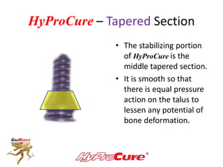 HyProCure – Tapered Section
• The stabilizing portion
of HyProCure is the
middle tapered section.
• It is smooth so that
there is equal pressure
action on the talus to
lessen any potential of
bone deformation.
 