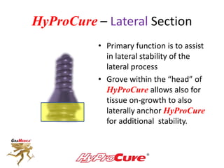 HyProCure – Lateral Section
• Primary function is to assist
in lateral stability of the
lateral process
• Grove within the “head” of
HyProCure allows also for
tissue on-growth to also
laterally anchor HyProCure
for additional stability.
 