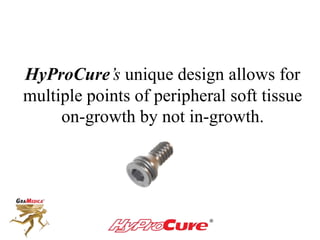 HyProCure’s unique design allows for
multiple points of peripheral soft tissue
on-growth by not in-growth.
 
