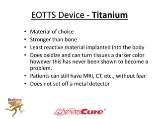 EOTTS Device - Titanium
• Material of choice
• Stronger than bone
• Least reactive material implanted into the body
• Does oxidize and can turn tissues a darker color
however this has never been shown to become a
problem.
• Patients can still have MRI, CT, etc., without fear
• Does not set off a metal detector
 