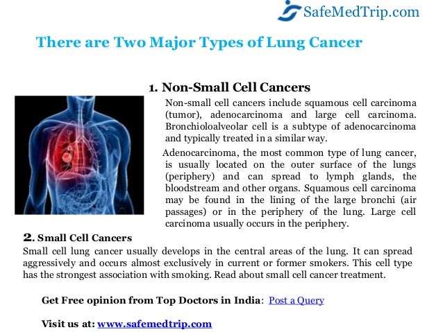 Why indian hospitals is best and cost effective for lung