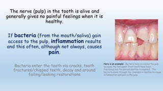 Why is a rct needed? | PPT