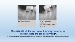 Why is a rct needed? | PPT