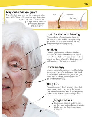 105
Wrinkles
The skin gets thinner and produces less
collagen, the protein that makes it elastic.
Less oil is made by skin, so it dries out. Lines
appear in places where the skin is stretched,
such as around the eyes and mouth.
Stiff joints
The cartilage and fluid between joints that
keeps them moving smoothly decreases.
This means bones can start to rub together,
and become stiff and sometimes painful.
Loss of vision and hearing
Wear and tear of muscles and tissue in
the eyes and ears makes them gradually
get worse. Ear and eye diseases are also
more common in older people.
Lower energy
Muscles start to lose strength and flexibility
so they can’t work for as long as they used
to. Your body clock also changes as you get
older, which means you sleep less and
get tired more quickly.
Fragile bones
Bones lose calcium and minerals
as they age, so they become weaker.
Older people often break bones
if they fall.
Why does hair go grey?
The cells that give your hair its colour are called
stem cells. These cells decrease and disappear
around the root of the hair as
you age, so the new hairs
grow without colour
and look grey.
Stem cells
Hair
Hair root
 