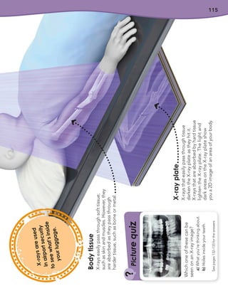115
Body
tissue
X-rays
easily
pass
through
soft
tissue,
such
as
skin
and
muscles.
However,
they
are
absorbed
as
they
pass
through
harder
tissue,
such
as
bone
or
metal.
X-ray
plate
X-rays
that
easily
pass
through
tissue
darken
the
X-ray
plate
as
they
hit
it.
X-rays
that
are
absorbed
by
hard
tissue
lighten
the
X-ray
plate.
The
light
and
dark
areas
on
the
X-ray
plate
show
you
a
2D
image
of
an
area
of
your
body.
Which
one
of
these
can
be
seen
on
an
X-ray
image?
a)
What
you’re
thinking
about.
b)
Holes
inside
your
teeth.
?
See
pages
132–133
for
the
answers
Pi
c
t
u
r
e
q
u
i
z
X
-
r
a
y
s
a
r
e
u
s
e
d
in
a
ir
p
o
r
t
s
e
c
u
r
it
y
t
o
s
e
e
w
h
a
t
’
s
in
s
id
e
y
o
u
r
lu
g
g
a
g
e
.
 