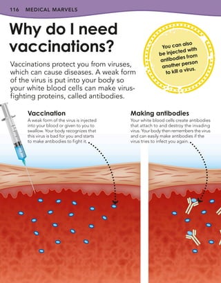 116
Vaccinations protect you from viruses,
which can cause diseases. A weak form
of the virus is put into your body so
your white blood cells can make virus-
fighting proteins, called antibodies.
Why do I need
vaccinations?
MEDICAL MARVELS
You can also
be injected with
antibodies from
another person
to kill a virus.
Vaccination
A weak form of the virus is injected
into your blood or given to you to
swallow. Your body recognizes that
this virus is bad for you and starts
to make antibodies to fight it.
Making antibodies
Your white blood cells create antibodies
that attach to and destroy the invading
virus. Your body then remembers the virus
and can easily make antibodies if the
virus tries to infect you again.
 