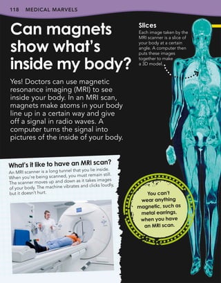 118 MEDICAL MARVELS
Yes! Doctors can use magnetic
resonance imaging (MRI) to see
inside your body. In an MRI scan,
magnets make atoms in your body
line up in a certain way and give
off a signal in radio waves. A
computer turns the signal into
pictures of the inside of your body.
Can magnets
show what’s
inside my body?
118
What’s it like to have an MRI scan?
An MRI scanner is a long tunnel that you lie inside.
When you’re being scanned, you must remain still.
The scanner moves up and down as it takes images
of your body. The machine vibrates and clicks loudly,
but it doesn’t hurt. You can’t
wear anything
magnetic, such as
metal earrings,
when you have
an MRI scan.
Slices
Each image taken by the
MRI scanner is a slice of
your body at a certain
angle. A computer then
puts these images
together to make
a 3D model.
 