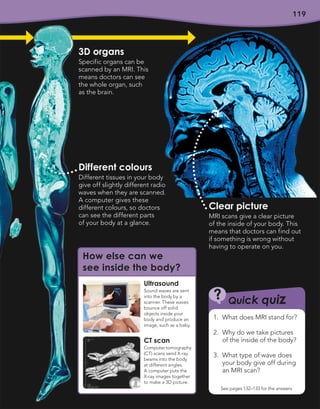 119
119
Clear picture
MRI scans give a clear picture
of the inside of your body. This
means that doctors can find out
if something is wrong without
having to operate on you.
Quick quiz
?
See pages 132–133 for the answers
1. What does MRI stand for?
2. Why do we take pictures
of the inside of the body?
3. What type of wave does
your body give off during
an MRI scan?
Different colours
Different tissues in your body
give off slightly different radio
waves when they are scanned.
A computer gives these
different colours, so doctors
can see the different parts
of your body at a glance.
3D organs
Specific organs can be
scanned by an MRI. This
means doctors can see
the whole organ, such
as the brain.
How else can we
see inside the body?
Ultrasound
Sound waves are sent
into the body by a
scanner. These waves
bounce off solid
objects inside your
body and produce an
image, such as a baby.
CT scan
Computer tomography
(CT) scans send X-ray
beams into the body
at different angles.
A computer puts the
X-ray images together
to make a 3D picture.
 