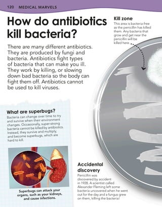 120 MEDICAL MARVELS
There are many different antibiotics.
They are produced by fungi and
bacteria. Antibiotics fight types
of bacteria that can make you ill.
They work by killing, or slowing
down bad bacteria so the body can
fight them off. Antibiotics cannot
be used to kill viruses.
How do antibiotics
kill bacteria?
What are superbugs?
Bacteria can change over time to try
and survive when their environment
changes. Occasionally, super-strong
bacteria cannot be killed by antibiotics.
Instead, they survive and multiply,
and become superbugs, which are
hard to kill.
Kill zone
This area is bacteria-free
as the penicillin has killed
them. Any bacteria that
grow and get near the
penicillin will be
killed here.
Superbugs can attack your
organs, such as your kidneys,
and cause infections.
Accidental
discovery
Penicillin was
discovered by accident
in 1928. A scientist called
Alexander Fleming left some
bacteria uncovered when he went
out for the day and a fungus grew
on them, killing the bacteria!
 