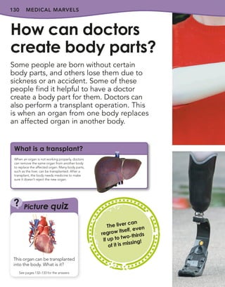130 MEDICAL MARVELS
Some people are born without certain
body parts, and others lose them due to
sickness or an accident. Some of these
people find it helpful to have a doctor
create a body part for them. Doctors can
also perform a transplant operation. This
is when an organ from one body replaces
an affected organ in another body.
How can doctors
create body parts?
The liver can
regrow itself, even
if up to two-thirds
of it is missing!
?
This organ can be transplanted
into the body. What is it?
See pages 132–133 for the answers
Picture quiz
When an organ is not working properly, doctors
can remove the same organ from another body
to replace the affected organ. Many body parts,
such as the liver, can be transplanted. After a
transplant, the body needs medicine to make
sure it doesn’t reject the new organ.
What is a transplant?
 