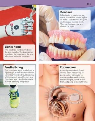131
Bionic hand
This electrical hand is wired into
the arm muscles. The brain sends
signals to the muscles in the arm,
which in turn move the hand.
Prosthetic leg
This prosthetic leg is made from a
lightweight material called carbon
fibre. It can bend without breaking,
which makes it useful for runners.
Prosthetic legs can also be made
of foam padding and plastic.
Pacemaker
A metal pacemaker is fitted
when a heart needs help to
pump. A tiny computer in
the pacemaker sends out an
electrical signal, which makes
the heart pump at the right time.
Dentures
False teeth, or dentures, are
made from either plastic, nylon,
or metal. They fit over the gum
and look just like real teeth.
They can be taken out and
cleaned at night.
 