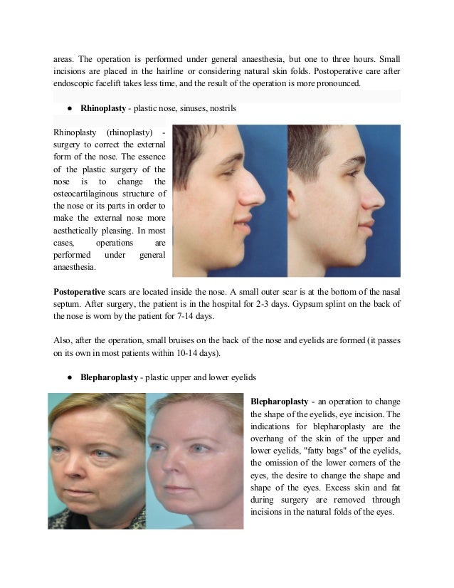 Why is cosmetic surgery called plastic_ surgery