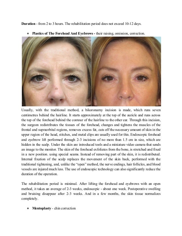 Why is cosmetic surgery called plastic_ surgery