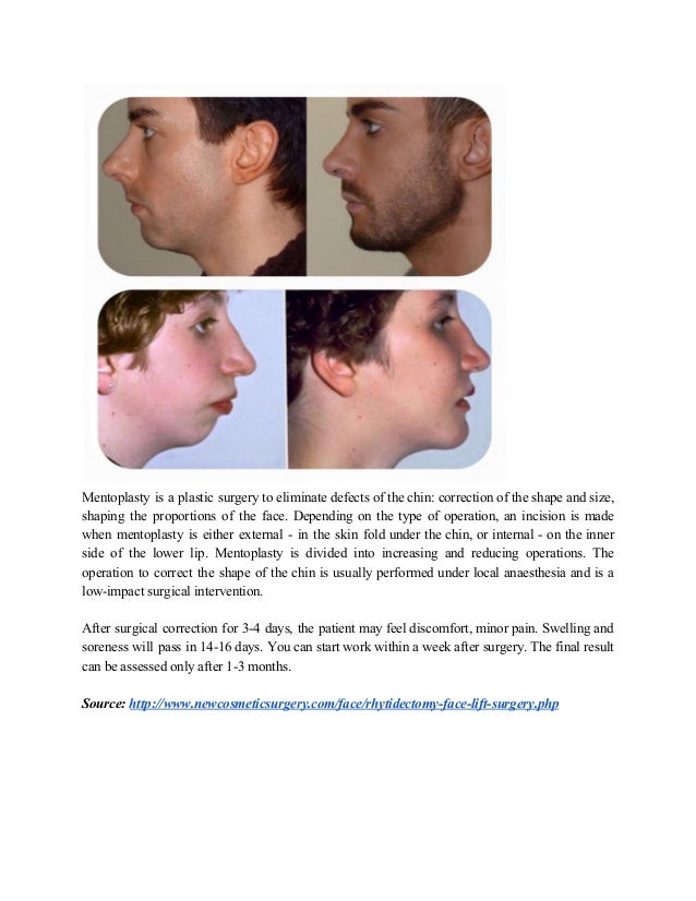 Why is cosmetic surgery called plastic_ surgery