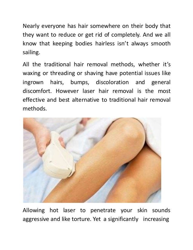 Best laser hair removal options