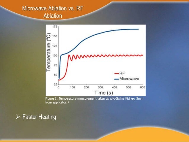 The Benefits of Microwave Ablation