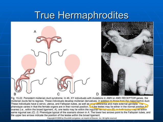 True Hermaphrodites True Hermaphrodites