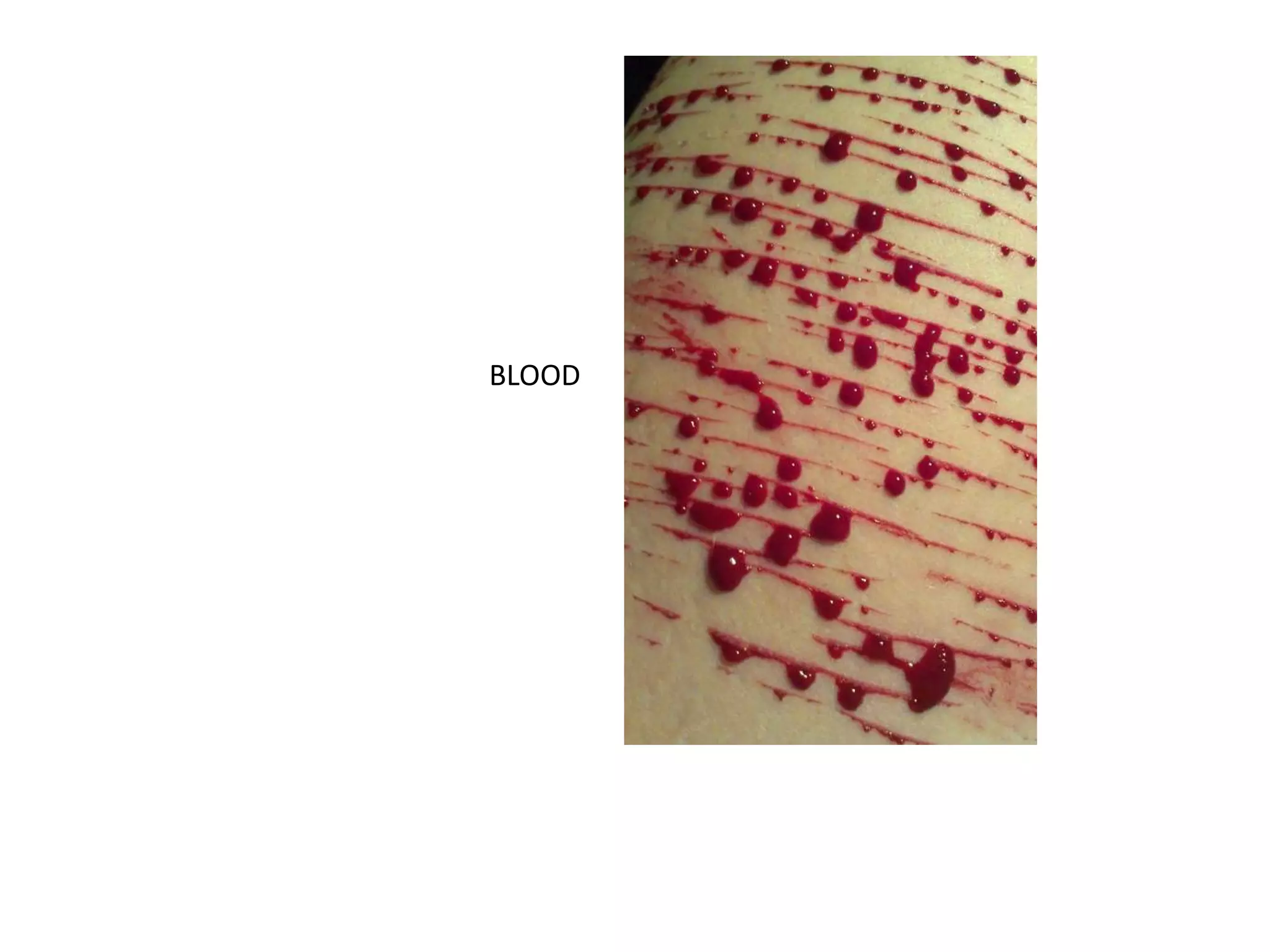 BLOOD
 