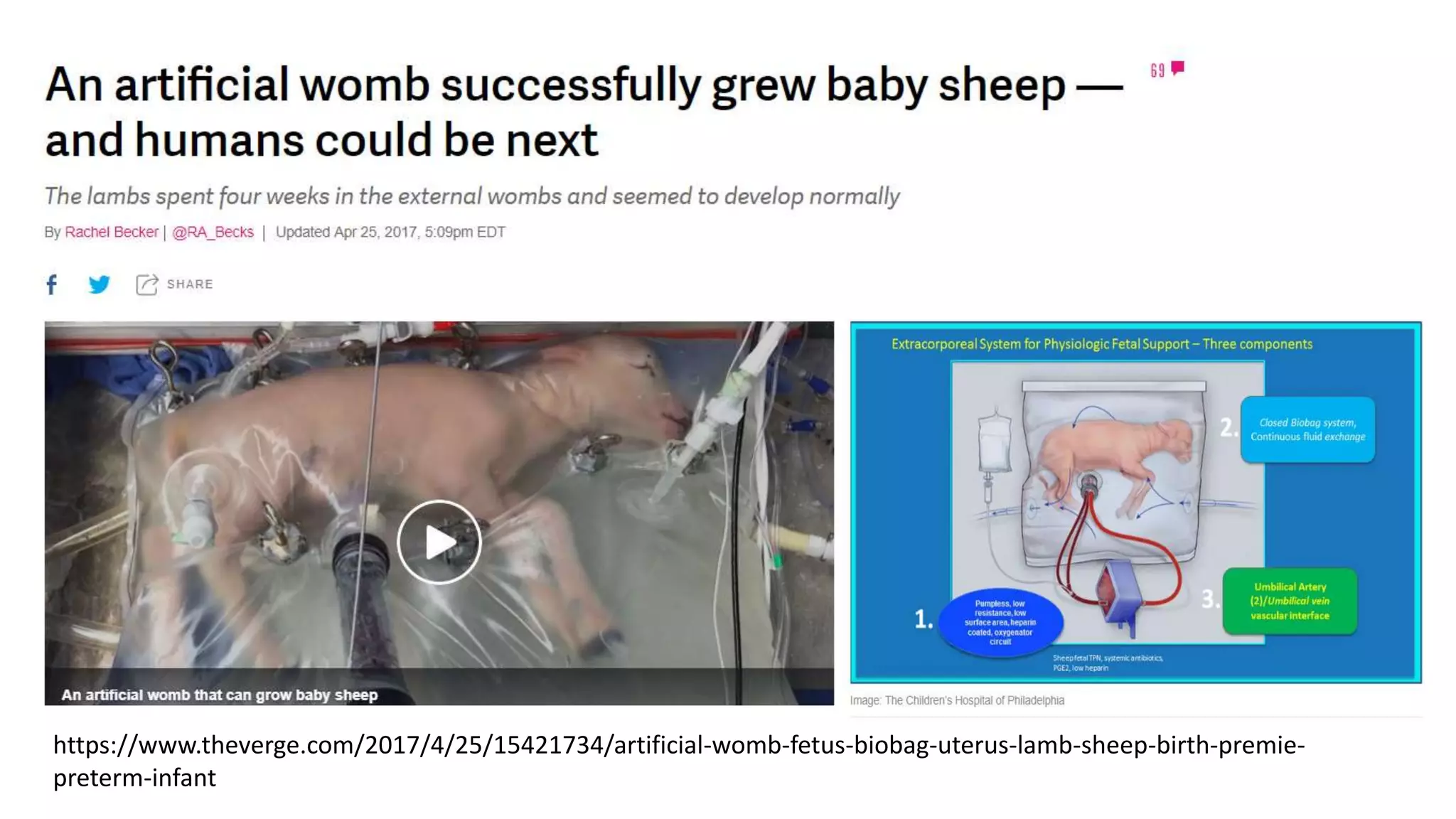 https://www.theverge.com/2017/4/25/15421734/artificial-womb-fetus-biobag-uterus-lamb-sheep-birth-premie-
preterm-infant
 
