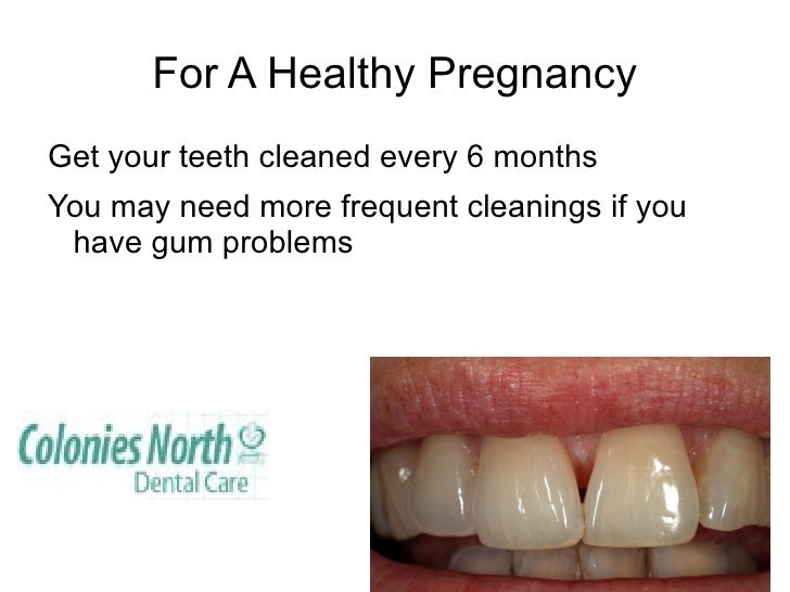 Why taking care of teeth during pregnancy means a healthy baby