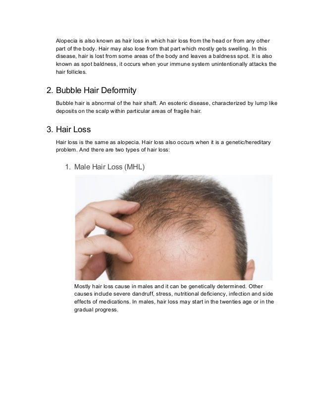 Why We Need Hair Doctor In Case Of Hair Disease