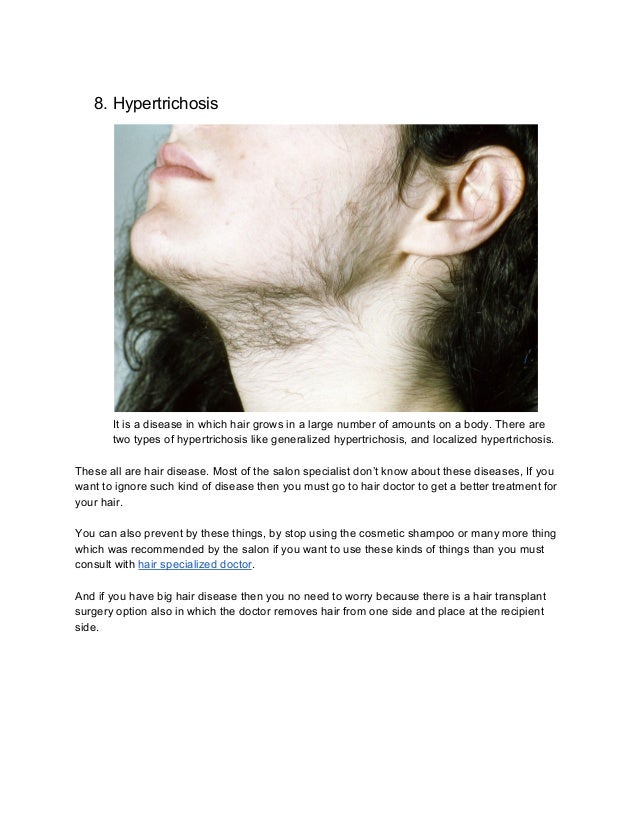 Why We Need Hair Doctor In Case Of Hair Disease