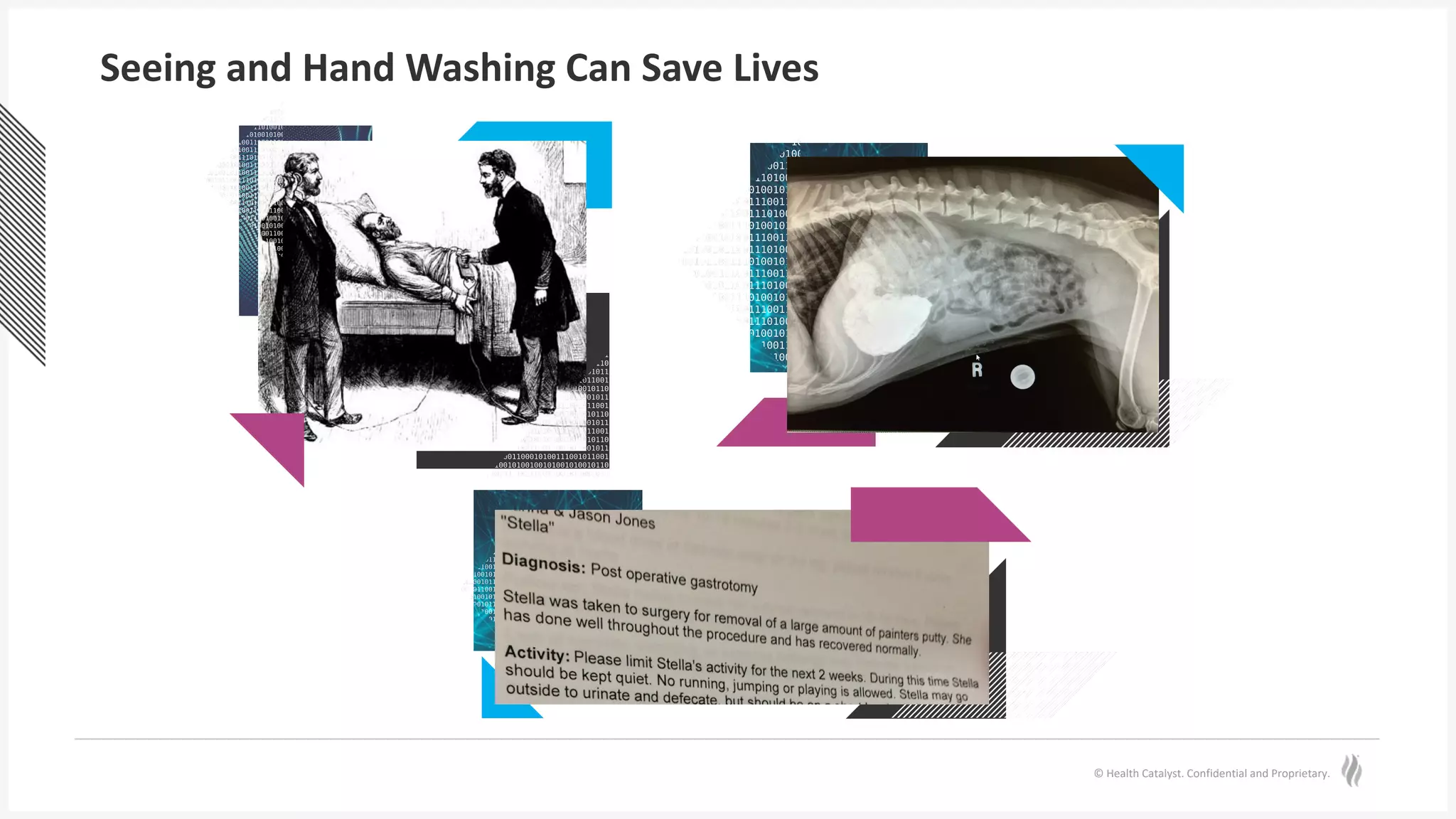 © Health Catalyst. Confidential and Proprietary.
Seeing and Hand Washing Can Save Lives
 