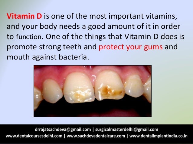 Why your teeth need vitamin d