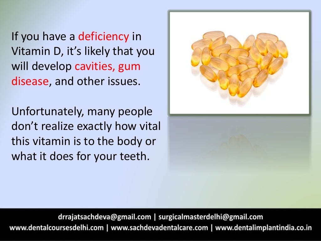 Why your teeth need vitamin d