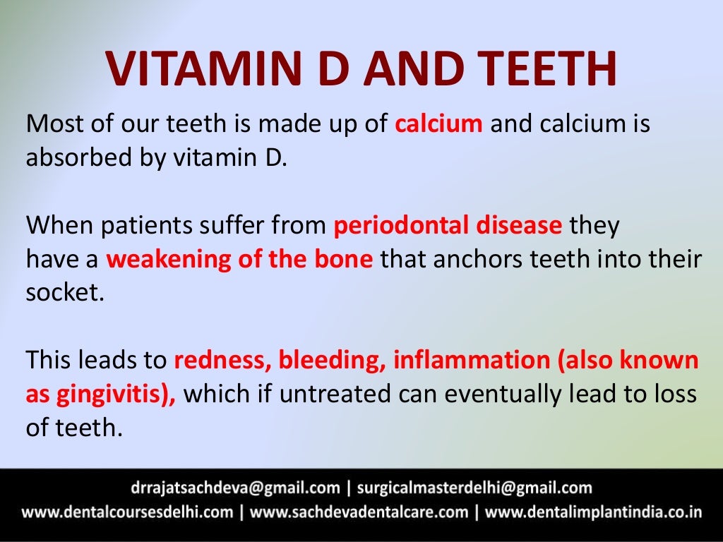 Why your teeth need vitamin d