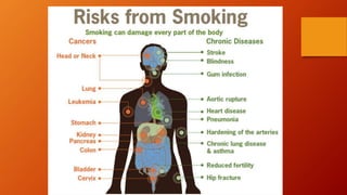 Why you should stop smoking | PPTX